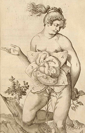 La chirurgia e ostetricia nel seicento